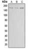 ATP Binding Cassette Subfamily A Member 8 antibody, orb360725, Biorbyt, Western Blot image 