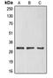 E74 Like ETS Transcription Factor 5 antibody, LS-C352155, Lifespan Biosciences, Western Blot image 