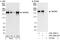 WD Repeat Domain 62 antibody, A301-560A, Bethyl Labs, Immunoprecipitation image 