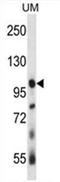Ubiquitin Specific Peptidase 4 antibody, AP54490PU-N, Origene, Western Blot image 