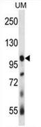 Ubiquitin carboxyl-terminal hydrolase 4 antibody, AP54490PU-N, Origene, Western Blot image 