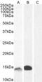 S100 Calcium Binding Protein A9 antibody, NBP1-18843, Novus Biologicals, Western Blot image 