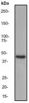 Mitogen-Activated Protein Kinase Kinase 7 antibody, ab52618, Abcam, Western Blot image 