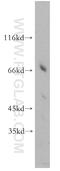 Heparanase 2 (Inactive) antibody, 21128-1-AP, Proteintech Group, Western Blot image 
