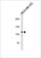 GEN1 Holliday Junction 5' Flap Endonuclease antibody, LS-C166438, Lifespan Biosciences, Western Blot image 