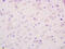 Solute Carrier Family 16 Member 2 antibody, GTX51095, GeneTex, Immunohistochemistry paraffin image 