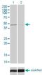 Tribbles Pseudokinase 3 antibody, H00057761-M03, Novus Biologicals, Western Blot image 