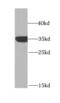 Glycerol-3-phosphate dehydrogenase [NAD+], cytoplasmic antibody, FNab03579, FineTest, Western Blot image 