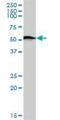 Serum/Glucocorticoid Regulated Kinase 1 antibody, H00006446-M01, Novus Biologicals, Western Blot image 