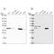 Phosphorylase Kinase Catalytic Subunit Gamma 2 antibody, NBP2-55815, Novus Biologicals, Western Blot image 