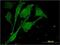 Membrane Bound Transcription Factor Peptidase, Site 2 antibody, H00051360-M01, Novus Biologicals, Immunocytochemistry image 