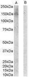 Erb-B2 Receptor Tyrosine Kinase 3 antibody, LS-B2126, Lifespan Biosciences, Western Blot image 