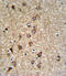 Solute Carrier Family 25 Member 37 antibody, A10701, Boster Biological Technology, Immunohistochemistry paraffin image 