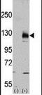Transient Receptor Potential Cation Channel Subfamily M Member 8 antibody, PA5-15509, Invitrogen Antibodies, Western Blot image 