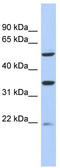 Solute Carrier Family 22 Member 24 antibody, TA335126, Origene, Western Blot image 