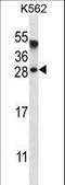 Amelogenin X-Linked antibody, LS-C156308, Lifespan Biosciences, Western Blot image 