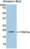 Adrenomedullin antibody, LS-C292665, Lifespan Biosciences, Western Blot image 