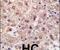 Proteasome Subunit Alpha 5 antibody, PA5-11509, Invitrogen Antibodies, Immunohistochemistry paraffin image 