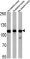 ATPase Sarcoplasmic/Endoplasmic Reticulum Ca2+ Transporting 1 antibody, MA3-911, Invitrogen Antibodies, Western Blot image 