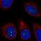 Transmembrane Protein 217 antibody, HPA045432, Atlas Antibodies, Immunofluorescence image 