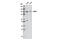 OCRL Inositol Polyphosphate-5-Phosphatase antibody, 8797S, Cell Signaling Technology, Western Blot image 