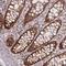 Coiled-Coil-Helix-Coiled-Coil-Helix Domain Containing 2 antibody, NBP1-94106, Novus Biologicals, Immunohistochemistry frozen image 