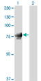 Junction Plakoglobin antibody, LS-B4364, Lifespan Biosciences, Western Blot image 