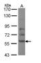 Dihydropyrimidinase Like 2 antibody, PA5-29728, Invitrogen Antibodies, Western Blot image 