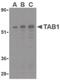 TGF-Beta Activated Kinase 1 (MAP3K7) Binding Protein 1 antibody, PA5-20084, Invitrogen Antibodies, Western Blot image 