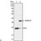 Nanog Homeobox antibody, LS-C812817, Lifespan Biosciences, Immunofluorescence image 