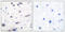 Protein Tyrosine Phosphatase Non-Receptor Type 11 antibody, LS-C199572, Lifespan Biosciences, Immunohistochemistry paraffin image 