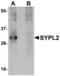 Synaptophysin Like 2 antibody, MBS151588, MyBioSource, Western Blot image 