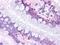 Prostaglandin D2 Receptor antibody, LS-A8133, Lifespan Biosciences, Immunohistochemistry paraffin image 