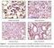 Peroxisome Proliferator Activated Receptor Gamma antibody, LS-C47203, Lifespan Biosciences, Immunohistochemistry paraffin image 