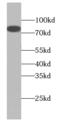 Collagen Type VIII Alpha 1 Chain antibody, FNab01847, FineTest, Western Blot image 