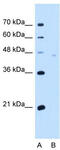 Neuroplastin antibody, TA341913, Origene, Western Blot image 