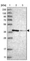 Methionine Adenosyltransferase 2B antibody, PA5-58075, Invitrogen Antibodies, Western Blot image 