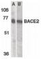 Beta-Secretase 2 antibody, PA5-19950, Invitrogen Antibodies, Western Blot image 