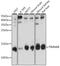 Translocase Of Inner Mitochondrial Membrane 8 Homolog B antibody, A15814, ABclonal Technology, Western Blot image 