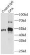 Lysosomal alpha-glucosidase antibody, FNab03271, FineTest, Immunoprecipitation image 