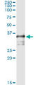 Translocase Of Outer Mitochondrial Membrane 34 antibody, LS-C139361, Lifespan Biosciences, Immunoprecipitation image 