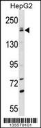 Patatin Like Phospholipase Domain Containing 6 antibody, 58-373, ProSci, Western Blot image 