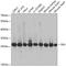 Triosephosphate Isomerase 1 antibody, GTX32936, GeneTex, Western Blot image 