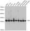 TPI antibody, GTX32936, GeneTex, Western Blot image 