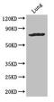 Solute Carrier Family 28 Member 3 antibody, CSB-PA884504LA01HU, Cusabio, Western Blot image 