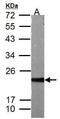 Histone chaperone ASF1B antibody, PA5-34866, Invitrogen Antibodies, Western Blot image 