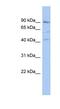 Poly(ADP-Ribose) Polymerase Family Member 12 antibody, NBP1-56436, Novus Biologicals, Western Blot image 