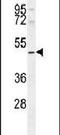 SET And MYND Domain Containing 1 antibody, PA5-24433, Invitrogen Antibodies, Western Blot image 