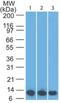 S100 Calcium Binding Protein A8 antibody, NBP2-27067, Novus Biologicals, Western Blot image 