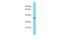 Olfactory receptor 3 antibody, A30194, Boster Biological Technology, Western Blot image 